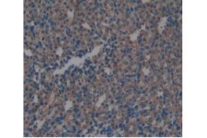Detection of ARG in Rat Kidney Tissue using Monoclonal Antibody to Arginase (ARG) (ARG Antikörper  (AA 1-323))