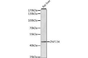Western blot analysis of extracts of rat liver, using ZNF134 antibody (ABIN7271455) at 1:1000 dilution. (ZNF134 Antikörper  (AA 100-180))