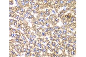 Immunohistochemistry of paraffin-embedded Rat liver using UGDH Polyclonal Antibody at dilution of 1:100 (40x lens). (UGDH Antikörper)