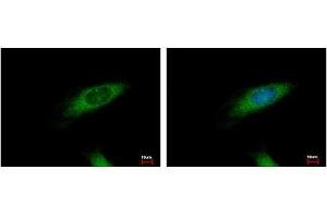 Image no. 3 for anti-Huntingtin Interacting Protein 1 Related (HIP1R) (N-Term) antibody (ABIN1494032)