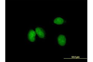 Immunofluorescence of purified MaxPab antibody to KCTD18 on HeLa cell.