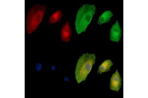 ABIN7095071 and ABIN7099127 staining  cells by IF/ICC.