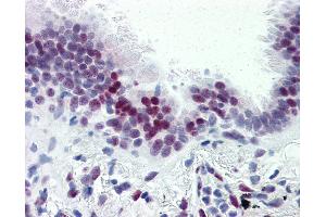 Anti-CASZ1 antibody IHC of human lung.
