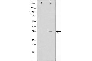 Western blot analysis on HeLa cell lysate using NPM Antibody,The lane on the left is treated with the antigen-specific peptide. (NPM1 Antikörper  (N-Term))