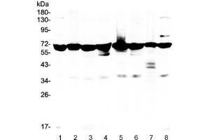 Western blot testing of 1) rat kidney, 2) rat brain, 3) mouse stomach, 4) mouse spleen, 5) human HeLa, 6) U87, 7) PANC lysate with AIF antibody. (AIF Antikörper)