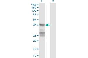 Western Blot analysis of CNN3 expression in transfected 293T cell line by CNN3 monoclonal antibody (M01), clone 4C4.