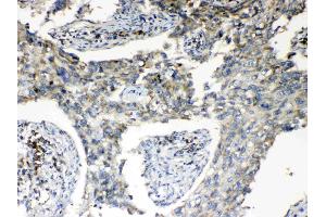 Immunohistochemistry (IHC) image for anti-Ribosomal Protein S6 (RPS6) (AA 13-52), (N-Term) antibody (ABIN5518869)