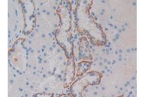 Detection of MET in Human Kidney Tissue using Polyclonal Antibody to C-Met (MET) (c-MET Antikörper  (AA 1092-1379))
