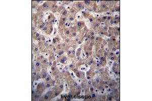 SULT1A3/SULT1A4 Antibody (N-term) (ABIN656776 and ABIN2845995) immunohistochemistry analysis in formalin fixed and paraffin embedded human liver tissue followed by peroxidase conjugation of the secondary antibody and DAB staining. (SULT1A3,SULT1A4 (AA 71-99), (N-Term) Antikörper)