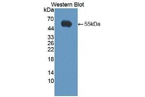 Detection of Recombinant KLK14, Human using Polyclonal Antibody to Kallikrein 14 (KLK14) (Kallikrein 14 Antikörper  (AA 36-267))