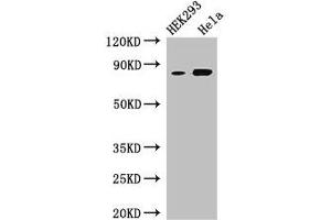 Western Blot Positive WB detected in: HEK293 whole cell lysate, Hela whole cell lysate All lanes: MELTF antibody at 3 μg/mL Secondary Goat polyclonal to rabbit IgG at 1/50000 dilution Predicted band size: 81, 33 kDa Observed band size: 81 kDa (MFI2 Antikörper  (AA 20-302))