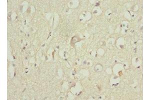 Immunohistochemistry of paraffin-embedded human brain tissue using ABIN7176117 at dilution of 1:100