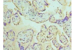 Immunohistochemistry of paraffin-embedded human placenta tissue using ABIN7145108 at dilution of 1:100 (ATG16L1 Antikörper  (AA 90-300))