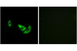 Immunofluorescence analysis of A549 cells, using DCT Antibody. (DCT Antikörper  (AA 51-100))