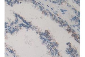 Immunohistochemistry (IHC) image for anti-Mitogen-Activated Protein Kinase-Activated Protein Kinase 2 (MAPKAPK2) (AA 139-367) antibody (ABIN7441769)