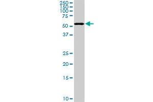 Western Blotting (WB) image for anti-3'-phosphoadenosine 5'-phosphosulfate Synthase 2 (PAPSS2) (AA 513-612) antibody (ABIN563924)