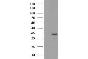 HEK293T cells were transfected with the pCMV6-ENTRY control (Left lane) or pCMV6-ENTRY KCTD14 (Right lane) cDNA for 48 hrs and lysed. (KCTD14 Antikörper)