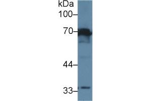 Western Blotting (WB) image for anti-Interleukin 1 Receptor, Type I (IL1R1) (AA 386-553) antibody (ABIN7437959)