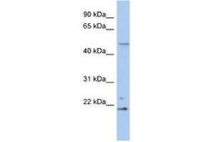 Image no. 1 for anti-Retinoblastoma Binding Protein 9 (RBBP9) (N-Term) antibody (ABIN6742511) (RBBP9 Antikörper  (N-Term))