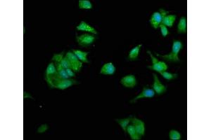 Immunofluorescence staining of MCF-7 cells with ABIN7162048 at 1:330, counter-stained with DAPI. (NME1 Antikörper  (AA 2-152))