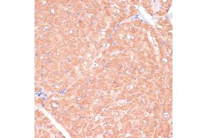 Immunohistochemistry of paraffin-embedded mouse heart using C antibody (ABIN7266010) at dilution of 1:100 (40x lens). (CACNB2 Antikörper  (AA 481-660))