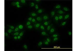 Immunofluorescence of monoclonal antibody to HMGB1 on HeLa cell. (HMGB1 Antikörper  (AA 1-90))