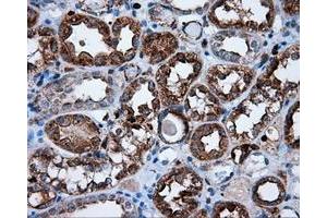 Immunohistochemical staining of paraffin-embedded Carcinoma of thyroid tissue using anti-RC219453 mouse monoclonal antibody. (NPR3 Antikörper)