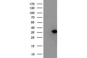 Western Blotting (WB) image for anti-Nucleotide Binding Protein-Like (NUBPL) (AA 1-250) antibody (ABIN1490634) (NUBPL Antikörper  (AA 1-250))
