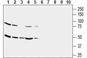 Western blot analysis of human U-87 MG glioblastoma cell line lysate (lanes 1 and 6), human THP-1 monocytic leukemia cell line lysate (lanes 2 and 7), human SH-SY5Y neuroblastoma cell line lysate (lanes 3 and 8), human MEG-01 megakaryoblastic leukemia cell line lysate (lanes 4 and 9) and human Jurkat T-cell leukemia cell line lysate (lanes 5 and 10): - 1-5. (SLC2A3 Antikörper  (1st Extracellular Loop))