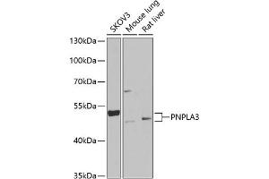 Western blot analysis of extracts of various cell lines, using PNPL Antibody (ABIN6132501, ABIN6145859, ABIN6145860 and ABIN6222404) at 1:1000 dilution. (PNPLA3 Antikörper  (AA 377-481))