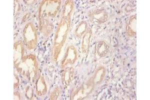 Immunohistochemistry of paraffin-embedded human kidney tissue using ABIN7159509 at dilution of 1:100 (MT1A Antikörper  (AA 1-59))