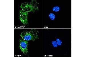 ABIN571066 Immunofluorescence analysis of paraformaldehyde fixed U251 cells, permeabilized with 0.