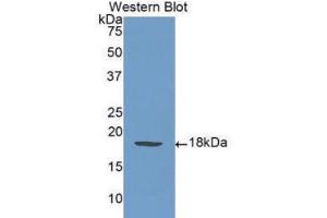 Western Blotting (WB) image for anti-Selectin P (Granule Membrane Protein 140kDa, Antigen CD62) (SELP) (AA 58-195) antibody (ABIN1078521) (P-Selectin Antikörper  (AA 58-195))