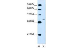 Image no. 1 for anti-Protein tyrosine Phosphatase, Non-Receptor Type 2 (PTPN2) (AA 23-72) antibody (ABIN205078) (PTPN2 Antikörper  (AA 23-72))