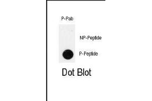 Image no. 1 for anti-Pancreatic and Duodenal Homeobox 1 (PDX1) (pThr11) antibody (ABIN358543) (PDX1 Antikörper  (pThr11))