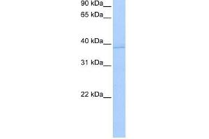 Human MCF-7; WB Suggested Anti-ANXA8L2 Antibody Titration: 0. (ANXA8L2 Antikörper  (N-Term))