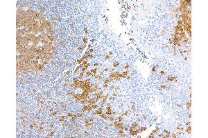 Immunohistochemistry (IHC) image for anti-CD38 (AA 43-300) antibody (ABIN7453961) (Rekombinanter CD38 Antikörper  (AA 43-300))