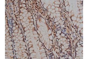 ABIN6268881 at 1/200 staining human colon tissue sections by IHC-P. (Desmin Antikörper)