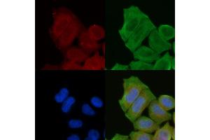 staining Hela cells(30 min of UV treatment) by IF/ICC. (PDE4B/C/D Antikörper)