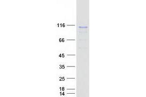 Validation with Western Blot (RSC1A1 Protein (Myc-DYKDDDDK Tag))