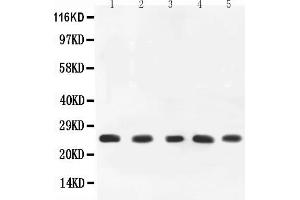 Anti-TNF alpha Picoband antibody, All lanes: Anti-TNF alpha at 0. (TNF alpha Antikörper  (AA 89-235))