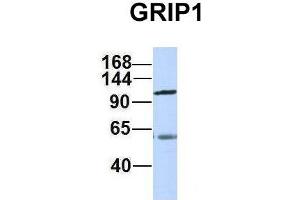 Host:  Rabbit  Target Name:  GRIP1  Sample Type:  Human Adult Placenta  Antibody Dilution:  1. (GRIP1 Antikörper  (C-Term))