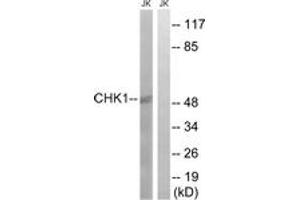 Western blot analysis of extracts from JurKat cells, using Chk1 (Ab-280) Antibody. (CHEK1 Antikörper  (AA 251-300))