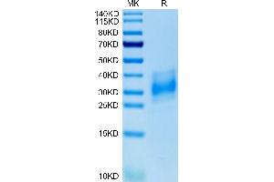 Human EMMPRIN/CD147 on Tris-Bis PAGE under reduced condition. (CD147 Protein (AA 22-205) (His tag))