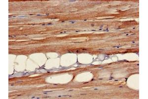 Immunohistochemistry (IHC) image for anti-UDP-Gal:betaGlcNAc beta 1,3-Galactosyltransferase, Polypeptide 4 (B3GALT4) (AA 42-266) antibody (ABIN7145371)