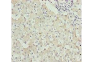 Immunohistochemistry of paraffin-embedded human liver tissue using ABIN7175709 at dilution of 1:100 (WDR45 Antikörper  (AA 1-360))
