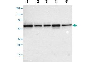 Western blot analysis of Lane 1: RT-4, Lane 2: EFO-21, Lane 3: A-431, Lane 4: Liver, Lane 5: Tonsil with TOM1 polyclonal antibody .