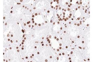 ABIN6267648 at 1/100 staining human kidney tissue sections by IHC-P. (SMC1A Antikörper  (pSer957))