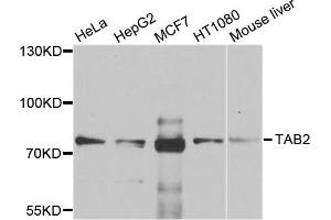Western blot analysis of extracts of various cell lines, using TAB2 antibody. (TAB2 Antikörper)