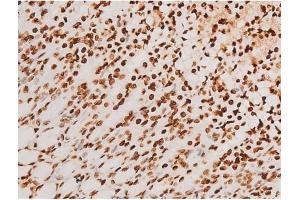 Immunohistochemistry (IHC) image for anti-Spleen tyrosine Kinase (SYK) (pTyr348) antibody (ABIN6255895)